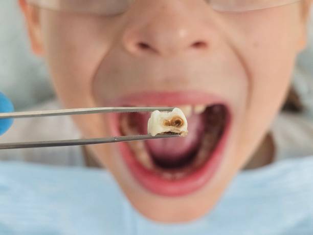 Best Emergency Cosmetic Dentistry in Oakley, UT